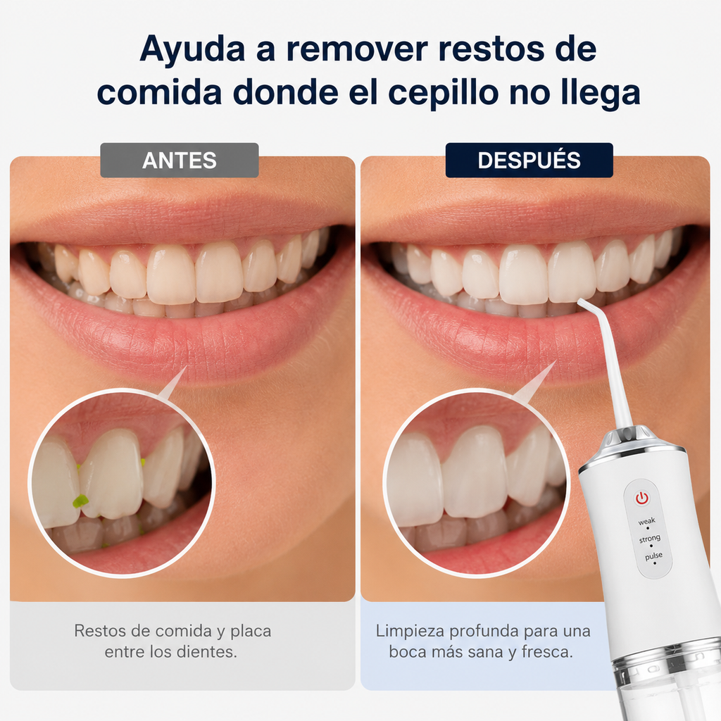 Irrigador Bucal Portátil de Limpieza Profunda