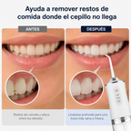 Irrigador Bucal Portátil de Limpieza Profunda