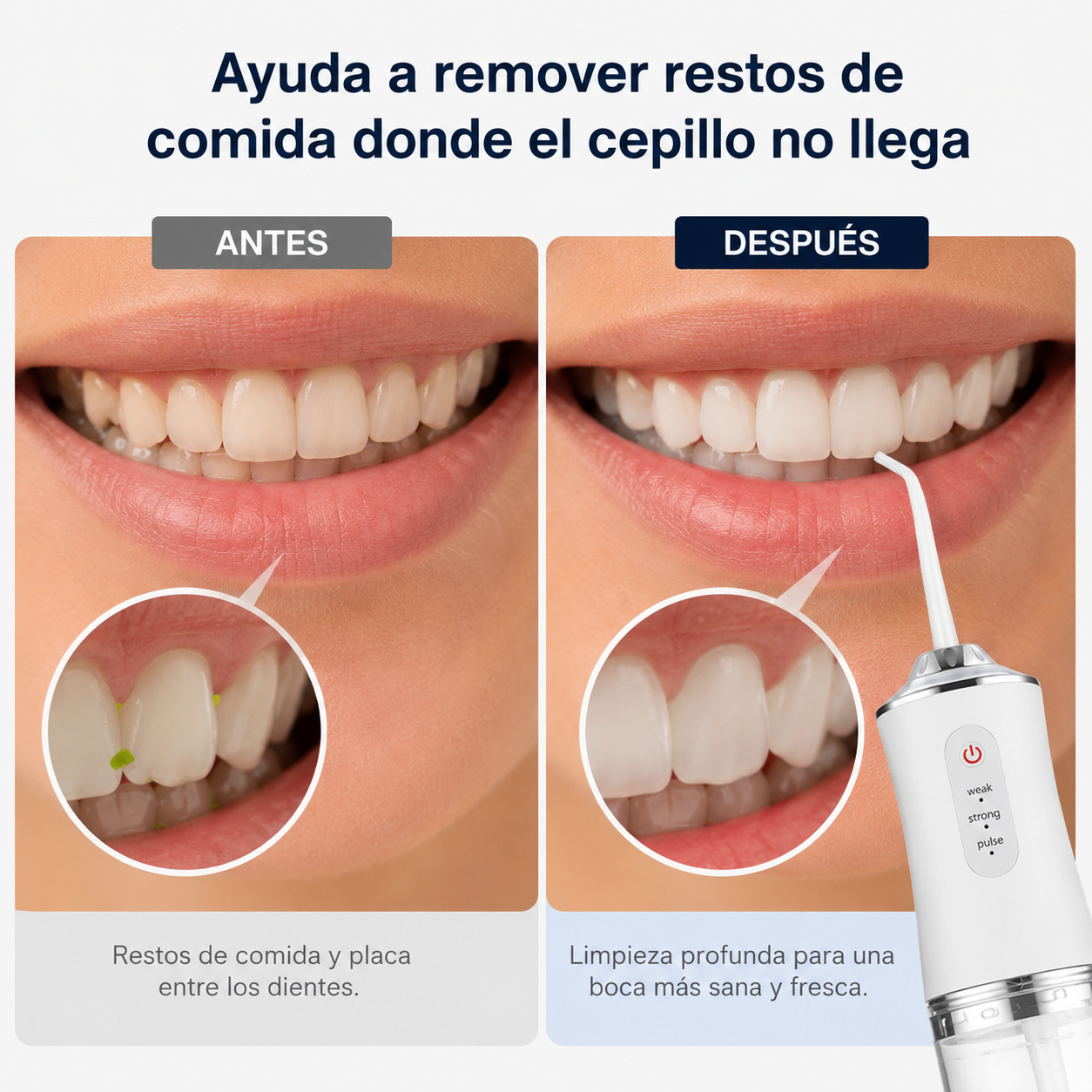 Irrigador Bucal Portátil de Limpieza Profunda